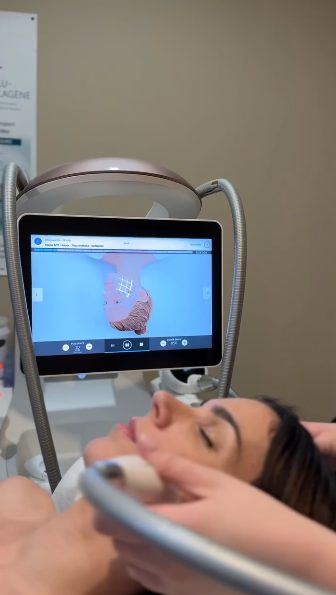 Soin LPG visage avec analyse de peau et tête de traitement — institut Secrets de Beauté Marie-Fleur, Rochefort-du-Gard